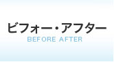 ビフォー・アフター